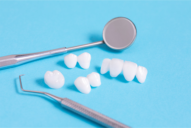 セラミック治療はこのような方におすすめです