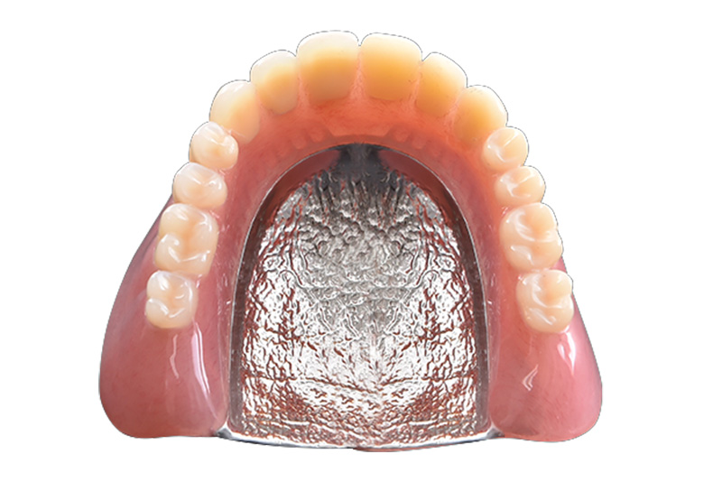 金属床義歯　自由診療