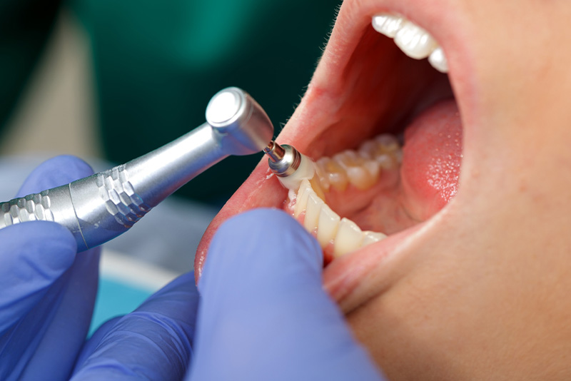 「予防」で治療の必要のないお口へ